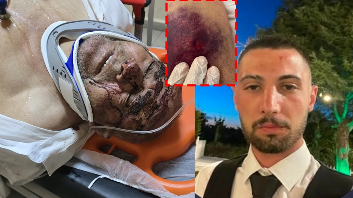 150 Bardak &Ccedil;ay İ&ccedil;in Yaşlı Adamı &Ouml;ld&uuml;resiye D&ouml;vd&uuml;