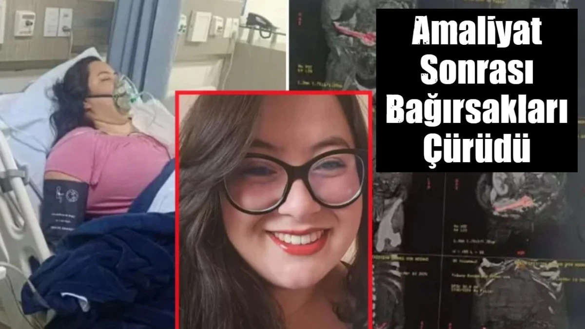 Amaliyat Sonrası Bağırsakları &Ccedil;&uuml;r&uuml;d&uuml;