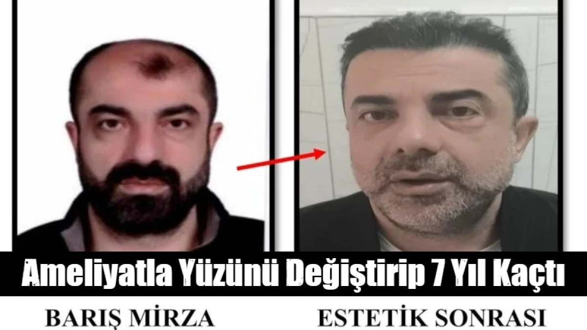 Ameliyatla y&uuml;z&uuml;n&uuml; değiştirdiği ortaya &ccedil;ıktı