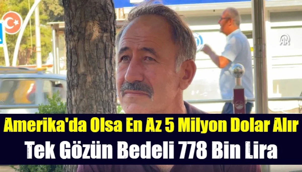 Amerika da olsa tek g&ouml;ze en az 5 milyon dolar alırdı