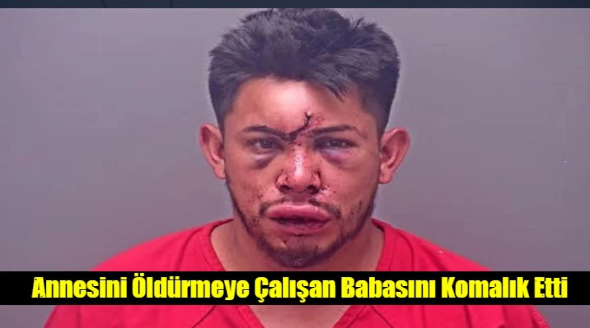 Annesini &Ouml;ld&uuml;rmeye &Ccedil;alışan Babasını Komalık Etti