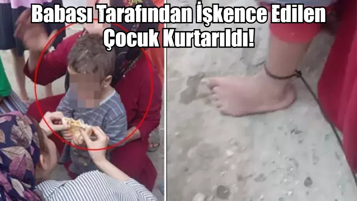 Babası Tarafından İşkence Edilen Çocuk Kurtarıldı!