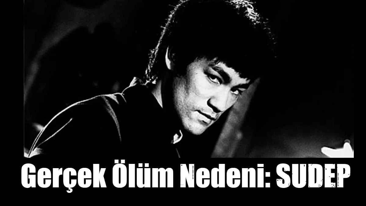 Bruce Lee’nin gerçek ölüm nedeni açıklandı