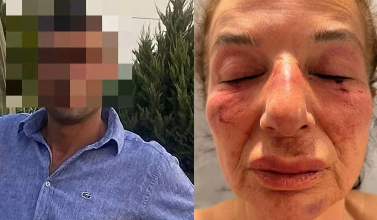 CHP&rsquo;li Belediye &Ccedil;alışanından Eczacı Kadına Hayvanlı Tuzak!
