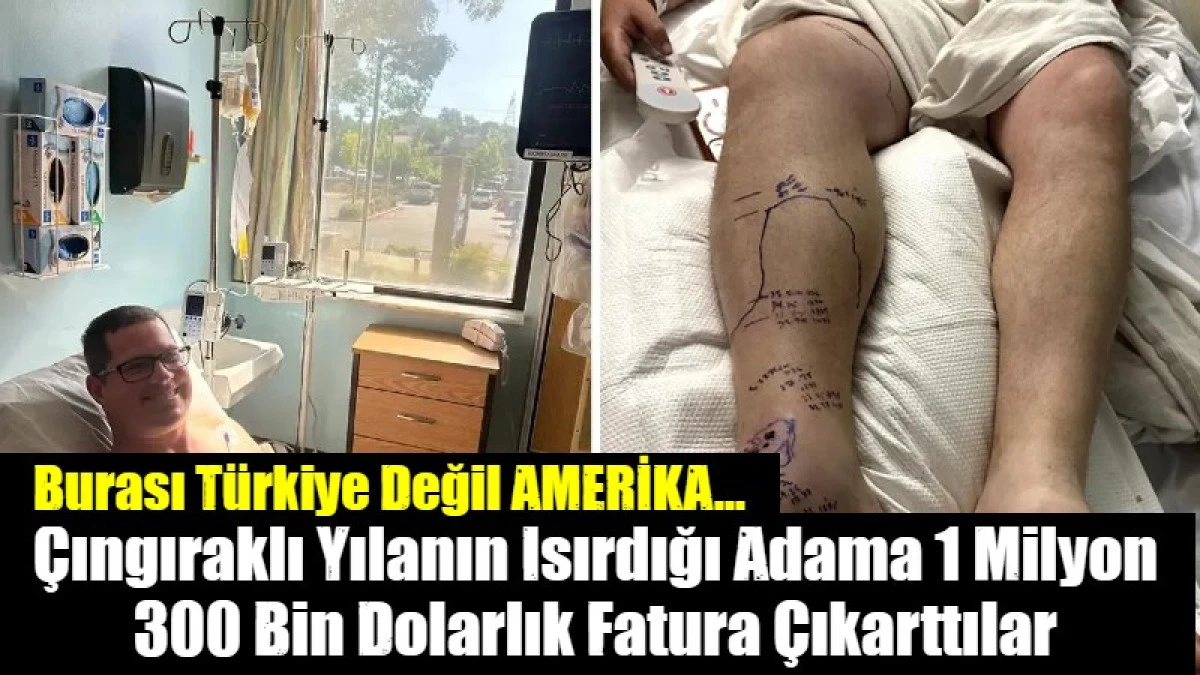 &Ccedil;ıngıraklı Yılanın Isırdığı Adama Milyon Dolarlık Fatura &Ccedil;ıkarttılar