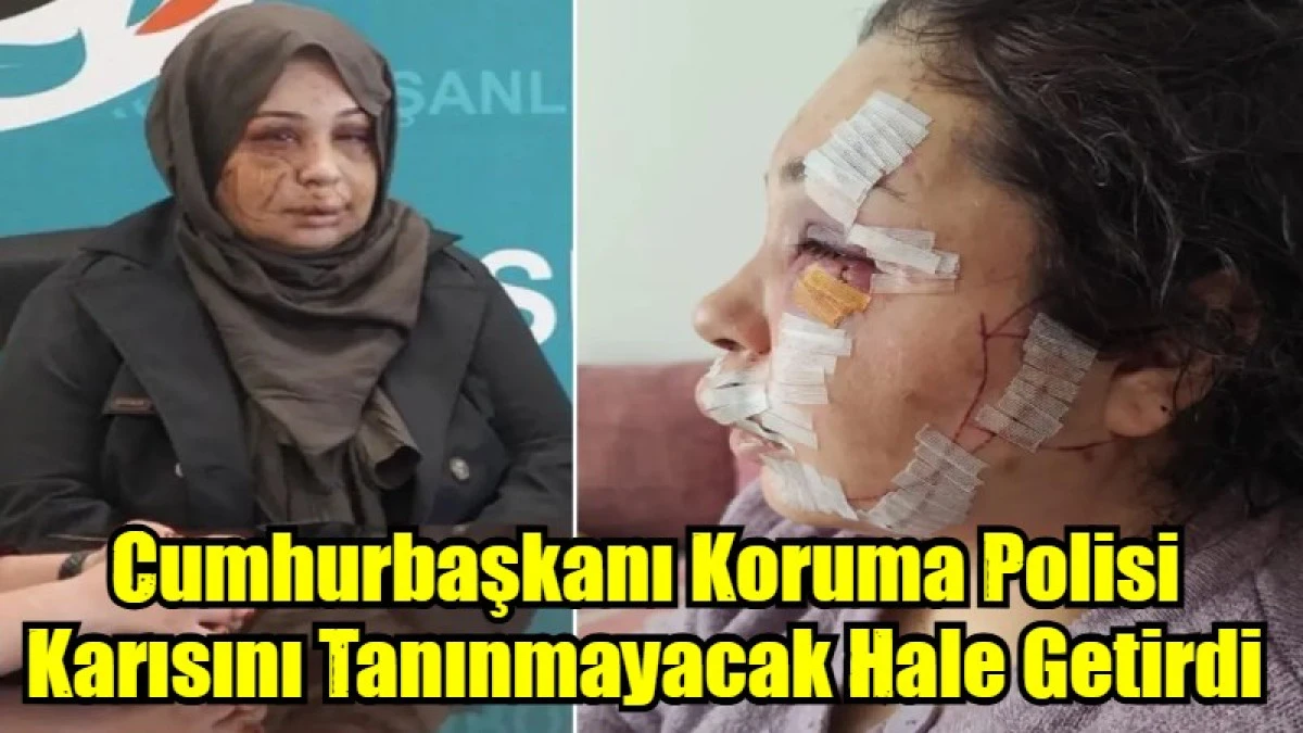 Cumhurbaşkanı Koruma Polisi  Karısını Tanınmayacak Hale Getirdi 
