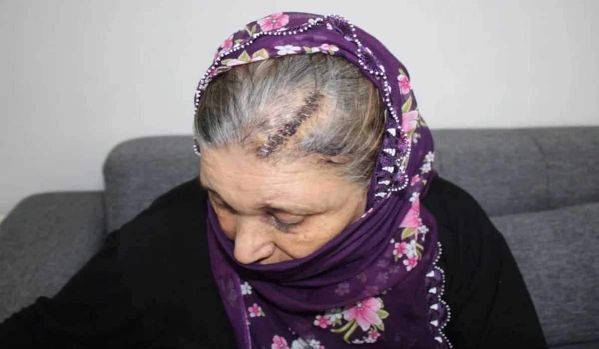 Diyarbakır'da Engelli Kızına Rampa Yapmak İsteyen Kadına Komşu k&uuml;rekle Saldırdı