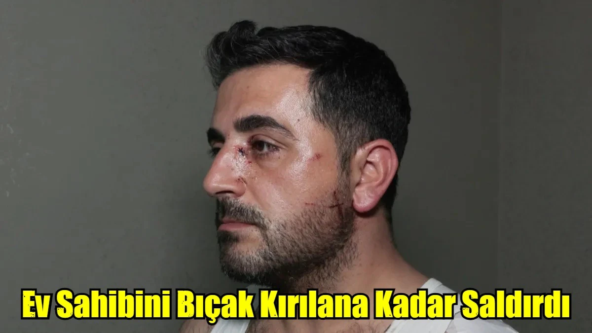 Ev Sahibini Bıçak Kırılana Kadar Saldırdı
