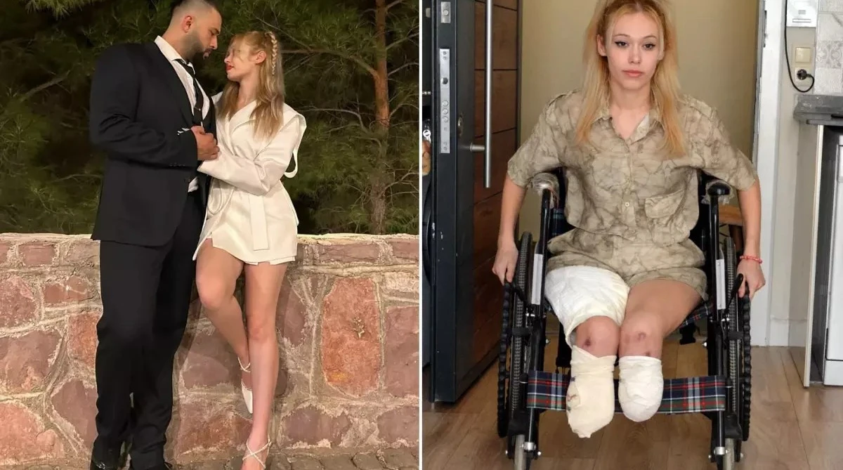 Evlilik Yıl Dönümünde 2 Ayağını Kaybetti