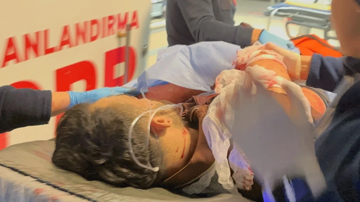 Karısına Kızıp Cama Yumruk Atmanın Bedeli Ağır Oldu