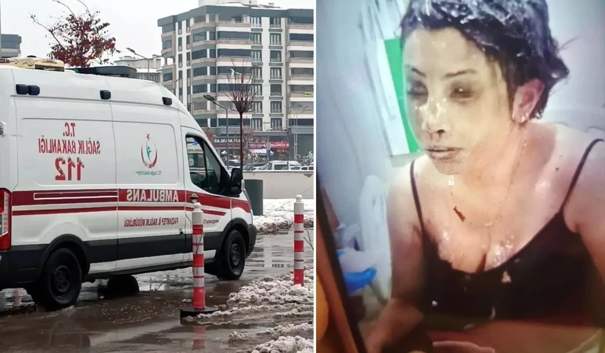 Karısının Elini Ayaklarını Koli Bantı İle Bantlayıp, Başından Aşağı Kezzap D&ouml;kt&uuml;