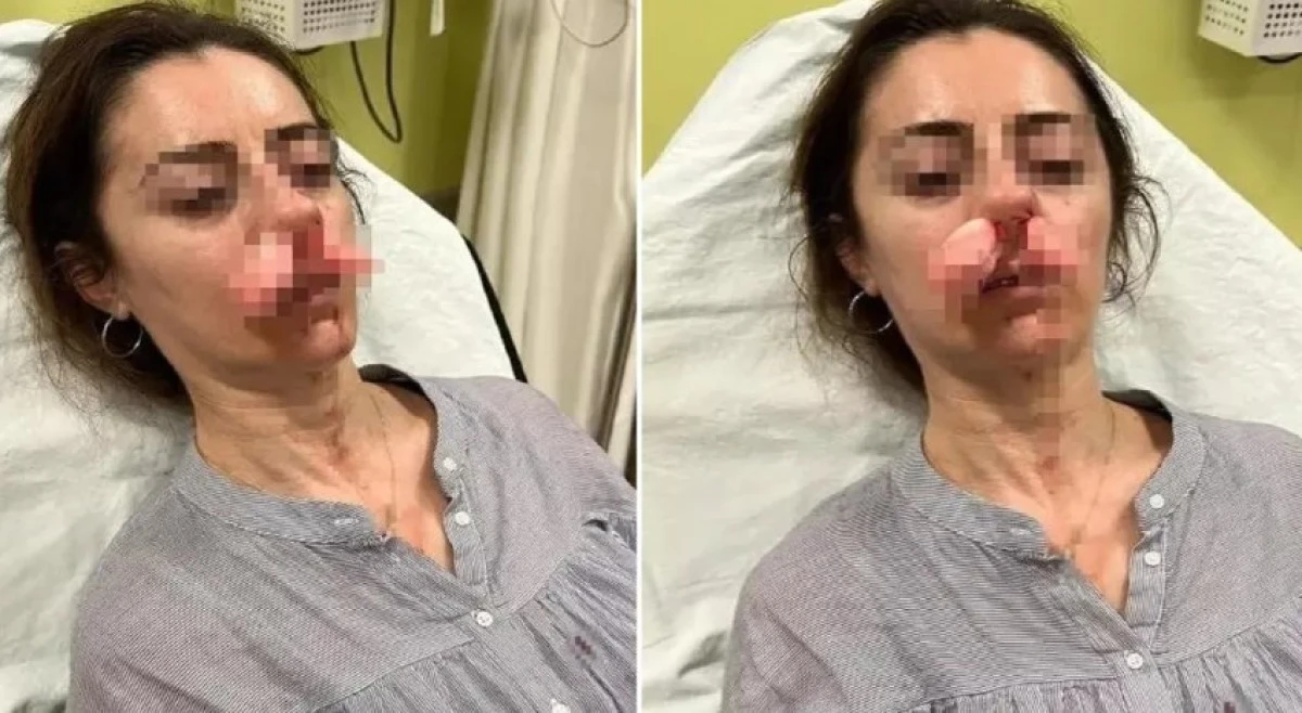 Kocasının Sevgilisi Zannedip Öldüresiye Dövdü