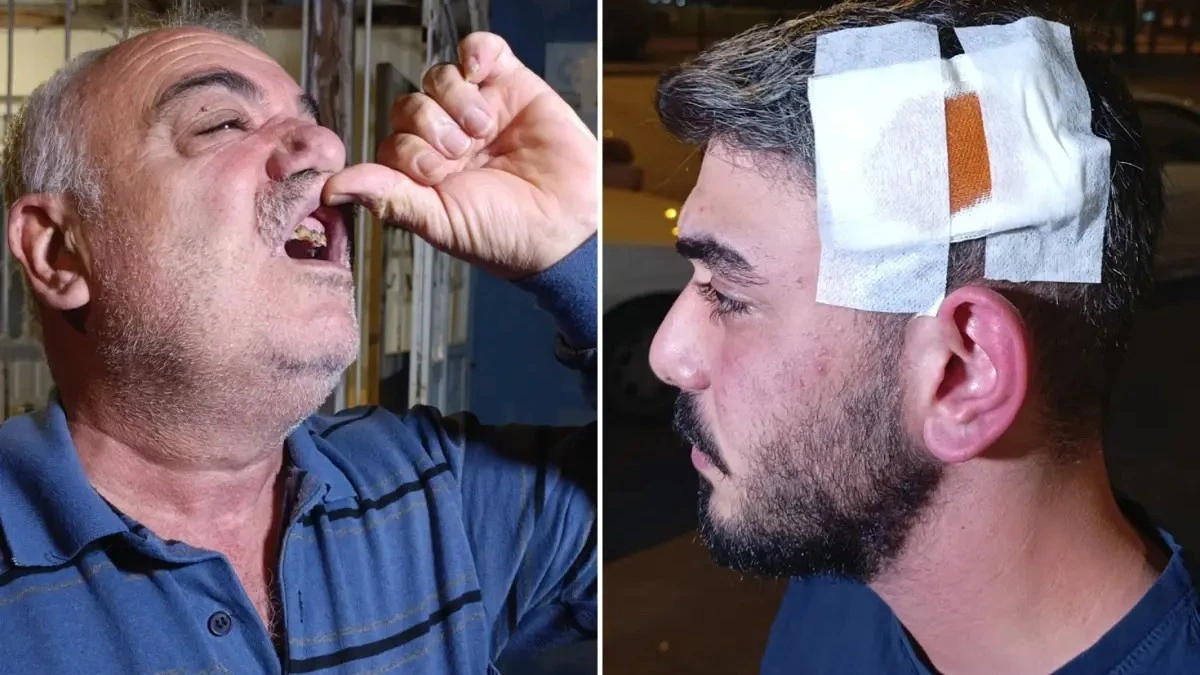 Manyak Komşu Adamın Dişlerini Kırıp Karısını ve Oğlunu Bıçakladı