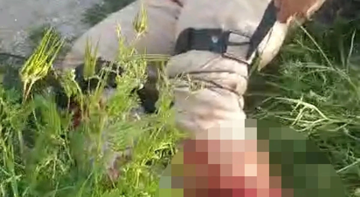  Motosikletteki yolcunun bacağı koptu