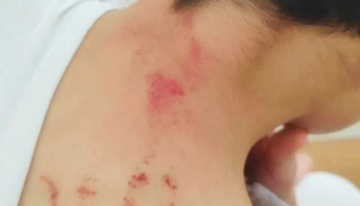 Öğrencisini Darbeden Öğretmen Tutuklandı