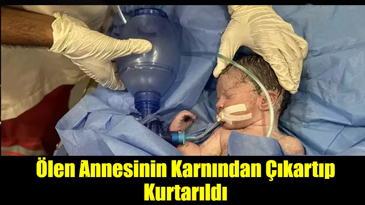 Ölen Annesinin Karnından Çıkartıp Kurtarıldı