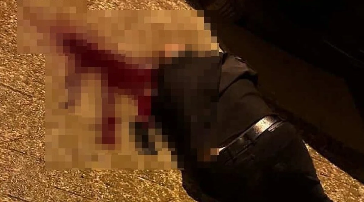 Sokakta Y&uuml;r&uuml;rken Başından Vuruldu