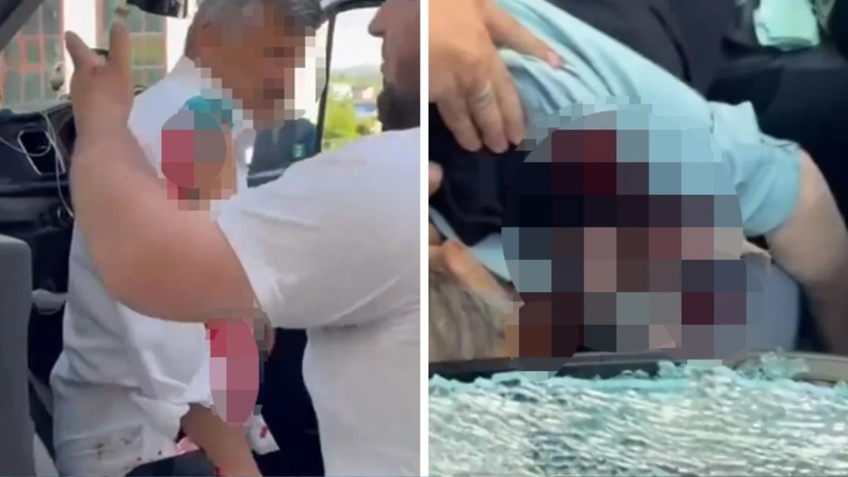 Trafikteki Tartışmada Kan Aktı