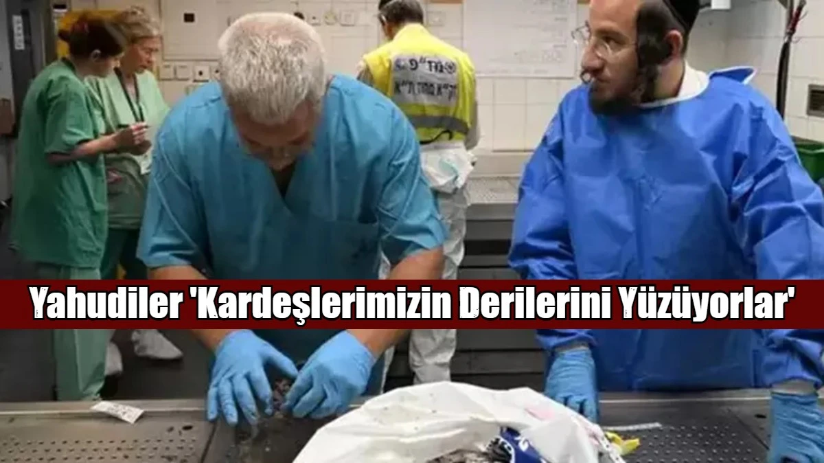 Yahudiler 'Kardeşlerimizin Derilerini Y&uuml;z&uuml;yorlar'